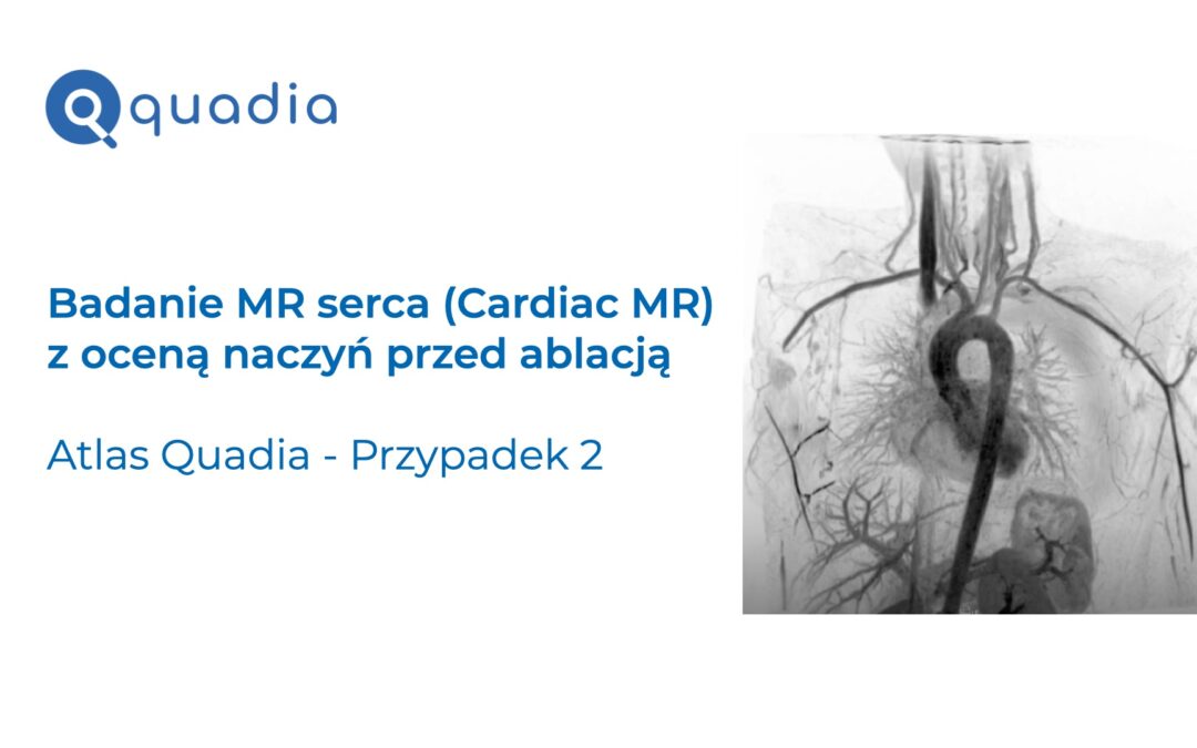 Przypadek 2 – Badanie MR serca (Cardiac MR) z oceną naczyń przed ablacją.